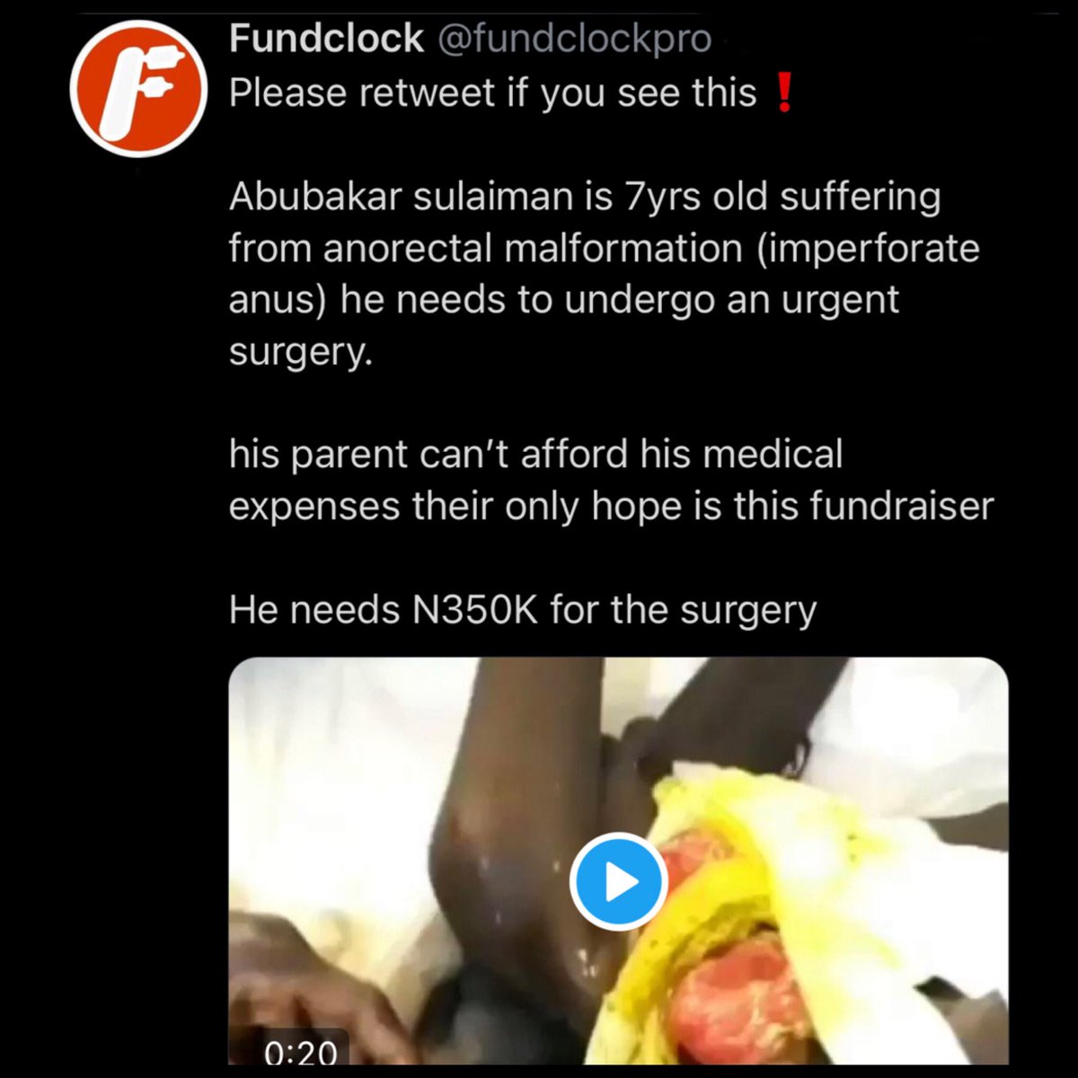 iam_skamal's tweet photo. Please don't pass without retweeting. https://t.co/Xz4ilsciFv