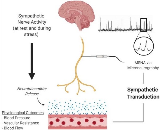 #MiniReview #ArticlesInPress: “Assessing static and dynamic sympathetic transduction using microneurography” By: Michael M. Tymko, et al.
bit.ly/3dnpkvC
<a href="/UAlberta/">University of Alberta</a> <a href="/lbert15/">Lindsey Berthelsen</a> <a href="/Asteele941/">Andrew Steele</a> @DrGrahamFrase <a href="/Craigsteinback/">Craig Steinback</a>
#JAPPL #Microneurography
