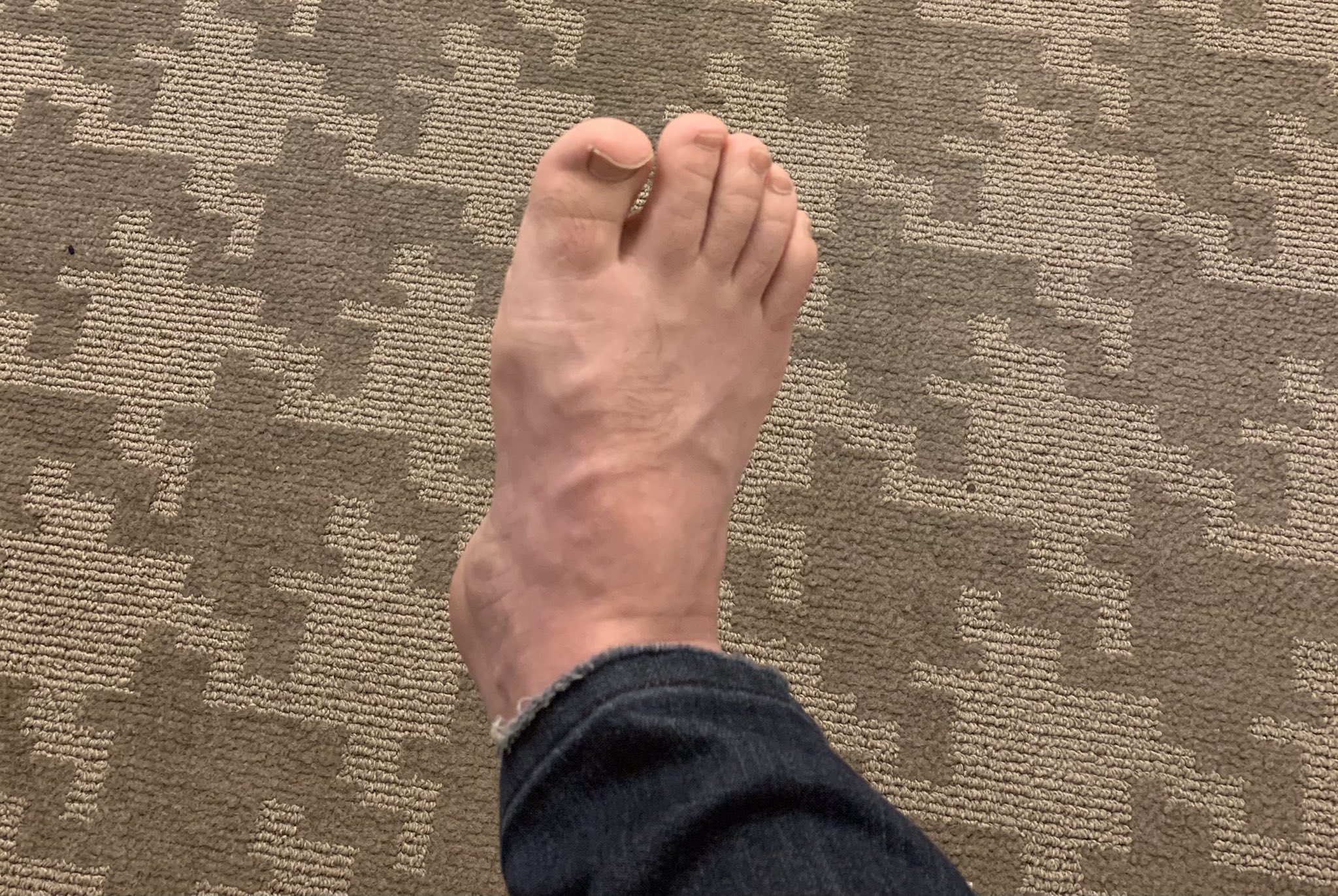 Brad Williams on X: Found out the “Catch me outside” girl made a million  bucks in six hours on OnlyFans, so here's a sample of my new Celebrity Dwarf  Feet page. #FirstOneIsFree