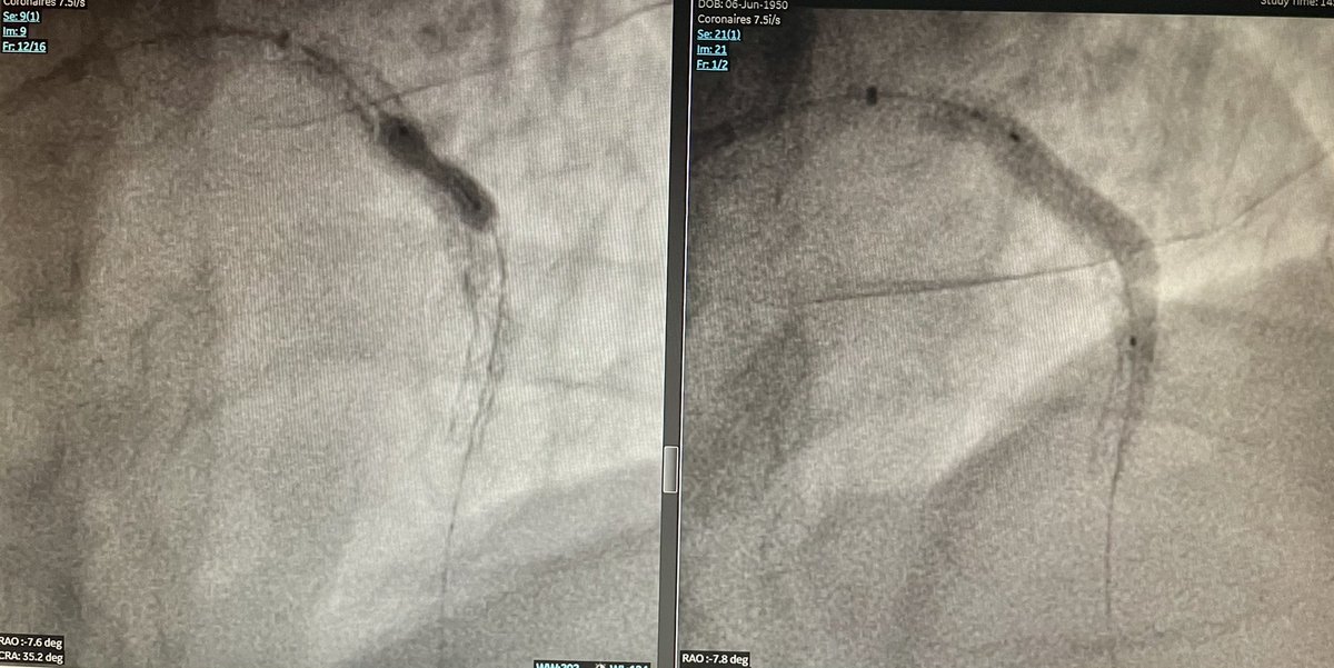 Spychaj Jean-Charles tweet media