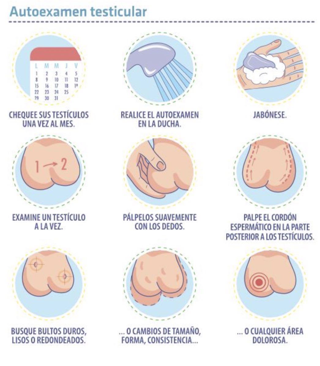 Cáncer testicular: la población joven es la más vulnerable. La práctica frecuente del autoexamen es esencial en la detección de esta patología, que el año pasado fue la de mayor presencia en hombres chilenos de entre 15 y 39 años