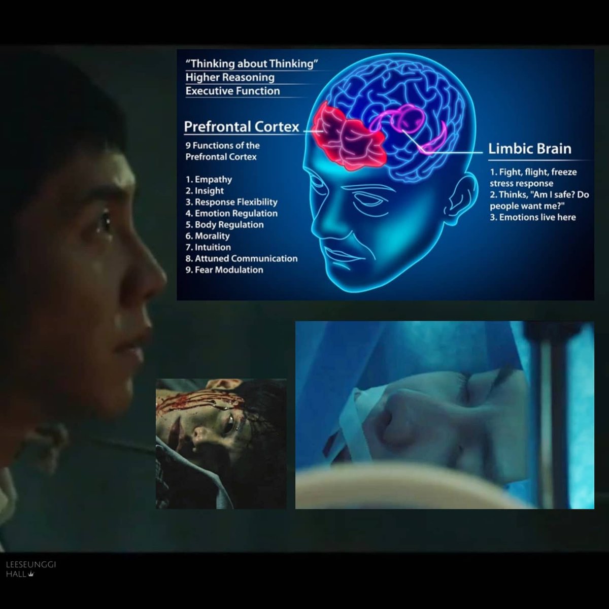 LSG_hall's tweet photo. Mengenal "transplantasi prefrontal cortex" yg exist di dunia kedokteran &amp; neuroscience, prosedur operasi yg justru "menormalkan" Jung Bareum dan gejala skizofrenia di #Mouse

membunuh orang lain atau 'dibunuh oleh teman halusinasi'
#LeeSeungGi #이승기 #마우스 https://t.co/YFacykPkdc