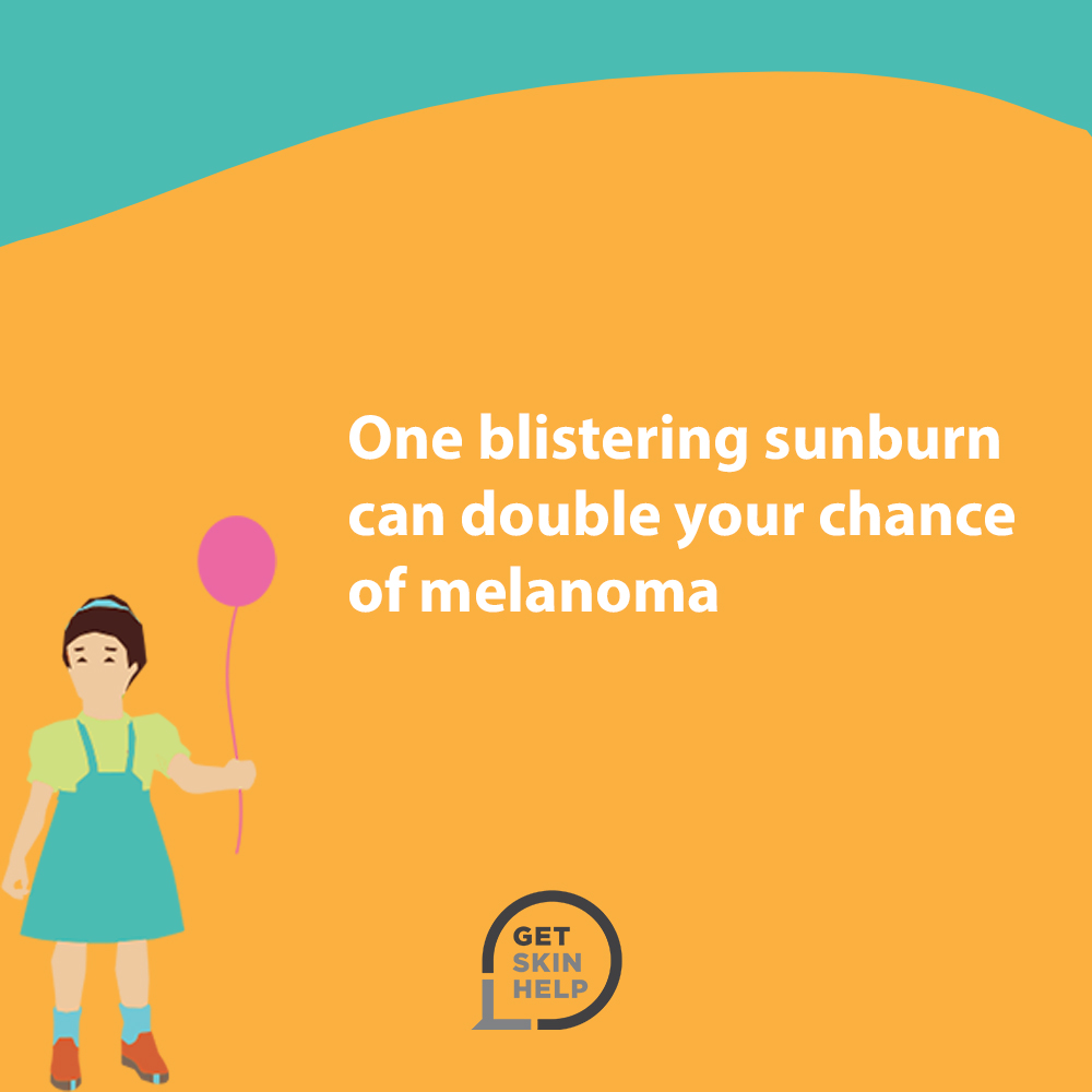 GetSkinHelpNow's tweet photo. According to a 2010 meta-analysis of 1,300 articles, one blistering sunburn in childhood or adolescence can more than double a person’s chance of developing melanoma later in life. #sunprotection #melanoma #UV #SPF #applysunscreen https://t.co/DqzFiLAO2n
