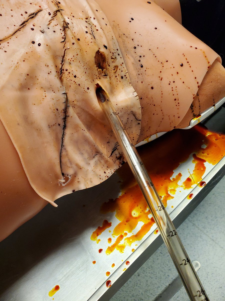 MSingh_MD's tweet photo. @Jacobi_EM Emergency Department-Trauma Combined In-Situ SIM #SimulationSavesLives #TeamWork #ClosedLoopCommunication #PrimarySurvey #ATLS #EMConf https://t.co/Qx4nMSqiFV