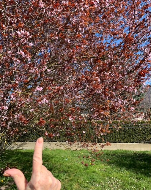 AFLIP_France's tweet photo. #United4Lipodystrophie #TousUnispourLipodystrophie #WorldLipodystrophyDay2021 #JournéeMondialeLipodystrophie2021 De plus en plus d’associations de patients se créent dans le monde, tous unis pour progresser ! https://t.co/E8qR7jqIzJ