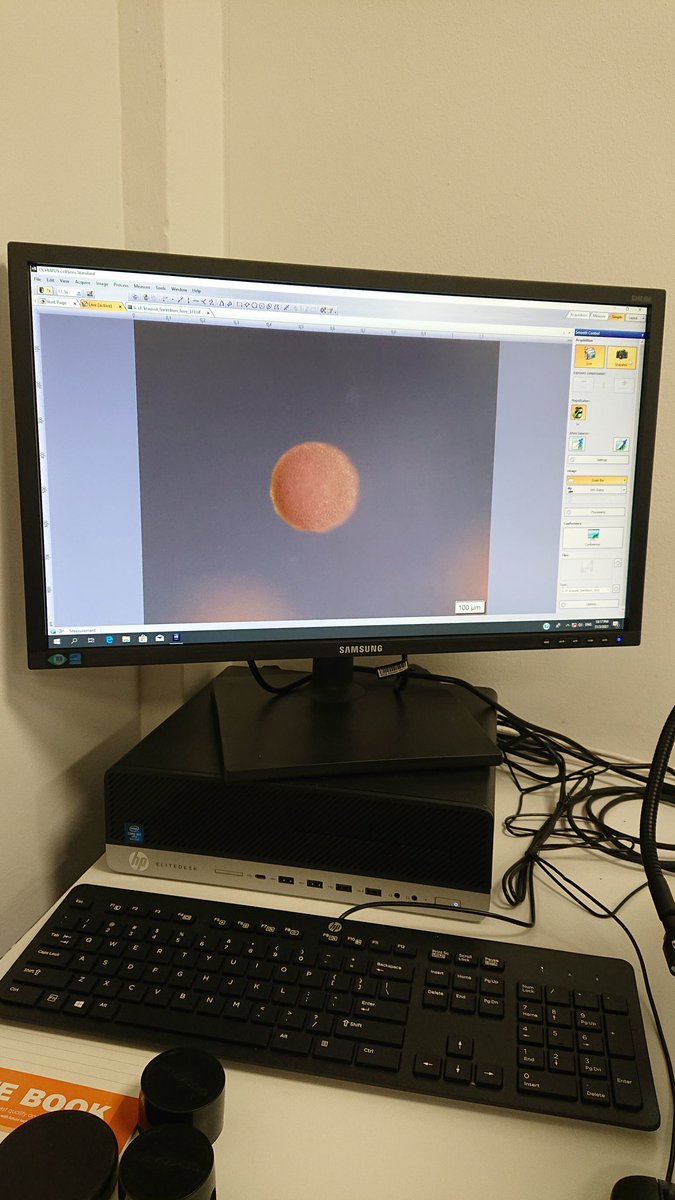 MeilinNeo's tweet photo. Which one is prettier? Coral egg or moon? π #coralspawning #Acropora #sjinml #coralsex #marinescience https://t.co/gjA13UeDt4