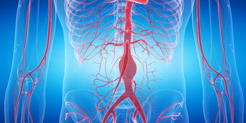 vascudex's tweet photo. Compartimos con vosotros este artículo sobre el aneurisma de aorta: claves de una amenaza que no avisa.
https://t.co/5gYCpQpXDE https://t.co/khizZuUN5C