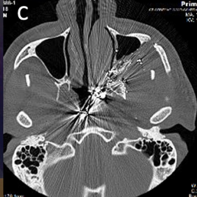 Viraj Shah, MD tweet media