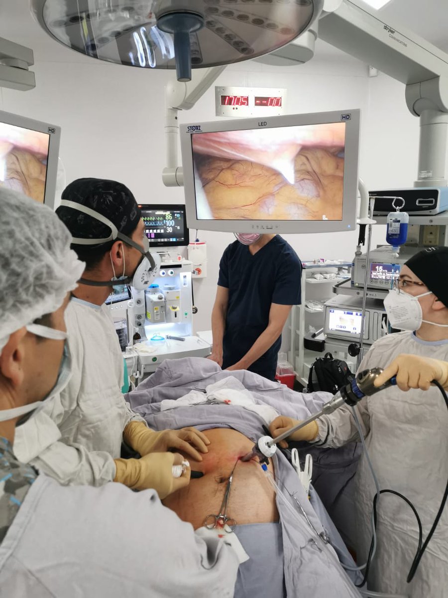 obexit's tweet photo. BYPASS GASTRICO EN Y DE ROUX LAPAROSCOPICO SIMPLIFICADO - DR CARLOS MORE... https://t.co/oJQcyqLtcQ a través de @YouTube Mis pininos en edición de videos en youtube, Véanlo y denle Like ! https://t.co/a9yN2NWuKN