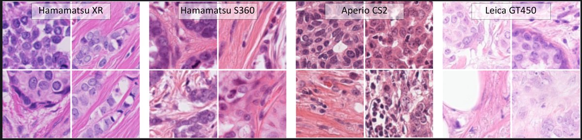 MAubreville's tweet photo. Tomorrow the training set of the #MICCAI #MIDOG 2021 challenge will be released. We are confident that we can give you a high quality data set and that it can help us to learn new strategies to adapt to #histopathology domain shift. (1/3) https://t.co/2nN1Kqoscm