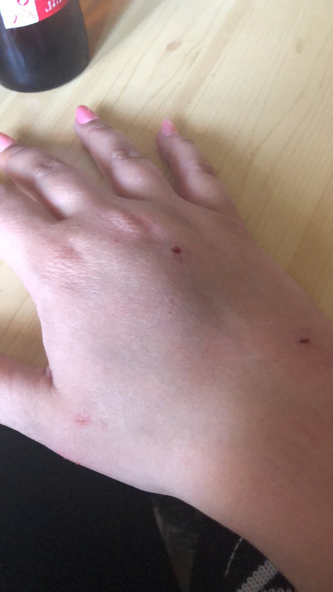 Francisite's tweet photo. Un DOCTOR a urgències no m'ha pogut atendre perquè era Polac i no mentenia. Algú ho pot fer visible per favor? @SionCap @ParisioProd @IB3noticies @arabalears https://t.co/Qs3VRCaenl