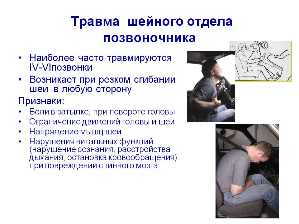повреждение шейных позвонков. хлыстовая травма шейного отдела позвоночника рентген. ушиб шейного позвонка. перелом шейного отдела позвонка. хлыстовая травма шейного отдела симптомы.