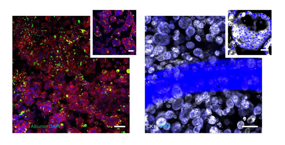 Organoid News (@organoidscience) on Twitter photo ✨ New in <a href="/NatureProtocols/">Nature Protocols</a>!
Milica Radisic (<a href="/milicaruoft/">Milica Radisic</a>) & <a href="/bme_uoft/">Biomedical Engineering @ University of Toronto</a> researchers describe a method to cultivate millimeter-scale functional vascularized tissues on a biofabricated platform that enables facile incorporation of #organoid technology.
go.nature.com/3rIFoNA ✨ New in <a href="/NatureProtocols/">Nature Protocols</a>!
Milica Radisic (<a href="/milicaruoft/">Milica Radisic</a>) & <a href="/bme_uoft/">Biomedical Engineering @ University of Toronto</a> researchers describe a method to cultivate millimeter-scale functional vascularized tissues on a biofabricated platform that enables facile incorporation of #organoid technology.
go.nature.com/3rIFoNA