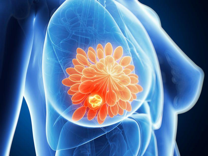 franceculture's tweet photo. Des chercheurs australiens ont découvert le gène responsable d'un type de cancer du sein particulièrement agressif ce qui pourrait potentiellement permettre d’augmenter le taux de survie des patientes. https://t.co/hTl3OipIqQ https://t.co/QQeTgq5ft0