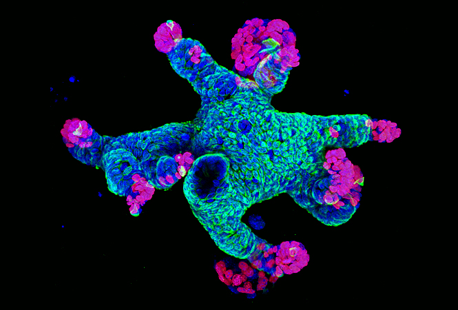 CellPressNews's tweet image. Looking for a convenient way to catch up on the latest #organoid #organengineering research? #CellSymposiaExpress offers a half-day session for esteemed scientists to exchange ideas on the hottest topics in your field. Register for free: hubs.ly/H0K4CMB0 #CSOrganoids2021