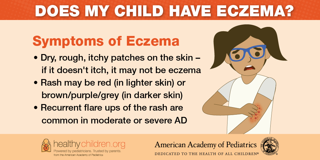 healthychildren's tweet photo. At least 1 in 10 children have eczema. It can be uncomfortable and can lead to infections. Learn more about this common skin condition and its symptoms here: https://t.co/44xbjnAfPn https://t.co/7qadtslHGA
