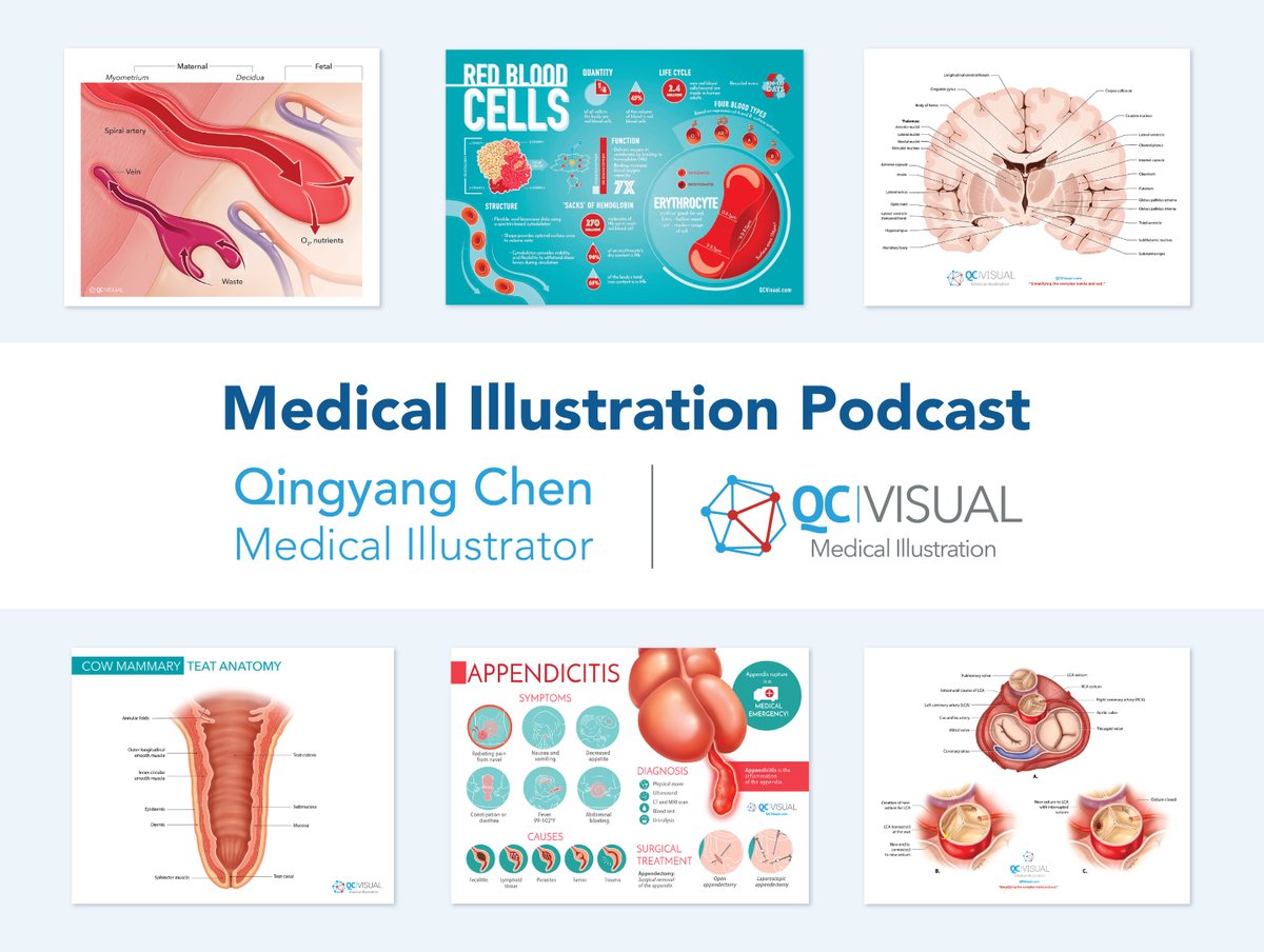 pizawL's tweet photo. New episode of the Medical Illustration Podcast! Hope you enjoy this conversation with award-winning medical illustrator and designer Qingyang Chen. https://t.co/xAlwND4I0u

#medicalillustration #illustration #scicomm #medart #sciart #sciencecommunication https://t.co/2mWjwoCNxS