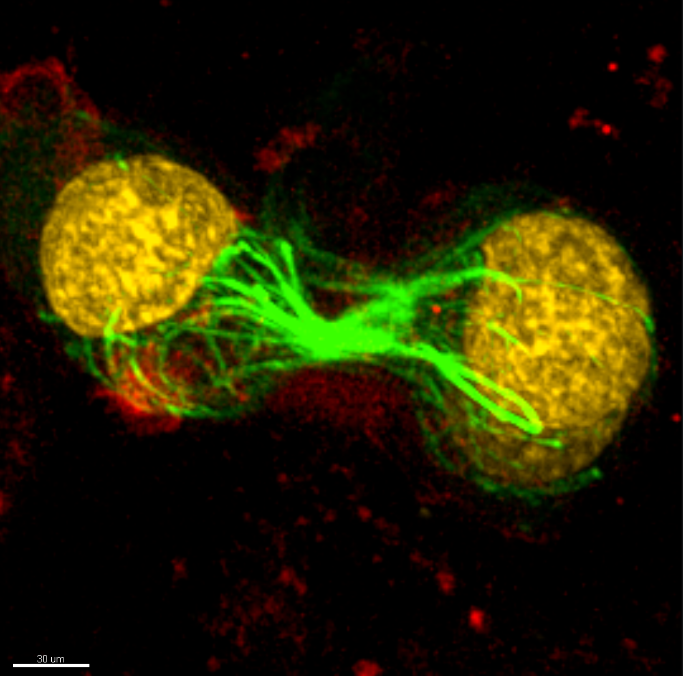 AndorTechnology's tweet photo. On a recent paper from Prof Gautam group, Dr Castillo-Badillo and colleagues used subcellular optogenetics tools, to locally activate the small GTPase RhoA.
👉Find out more https://t.co/ofbfaU5iAq
#AndorDragonfly #SRRFStream #Optogenetics https://t.co/XaNBaEgIhT