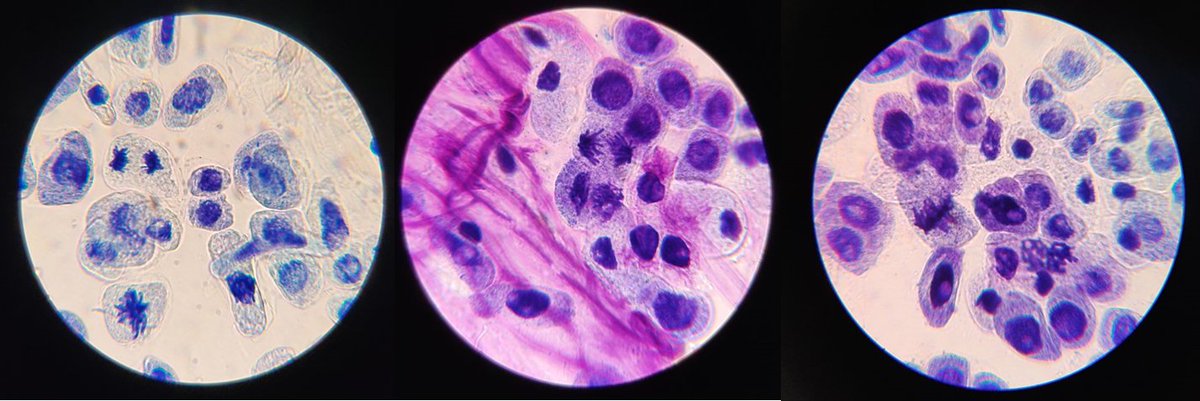 Bio_BHS's tweet photo. Our AH biologists were looking at calculating the mitotic index of a spider plant. 

Here are some of the cells they were able to view under the microscope🔬: https://t.co/BTeqCih2jg