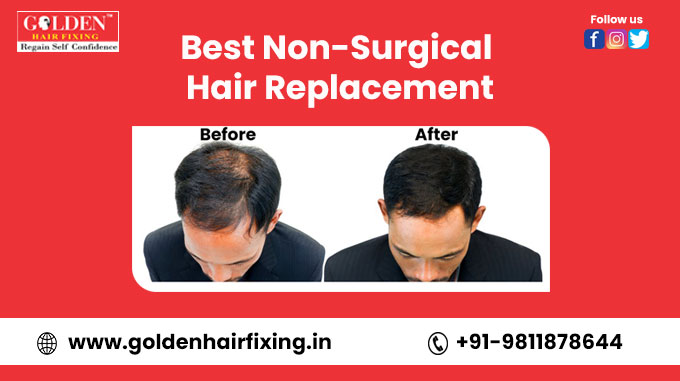 Golden Hair Fixing on Twitter: Golden Hair Fixing on Twitter: