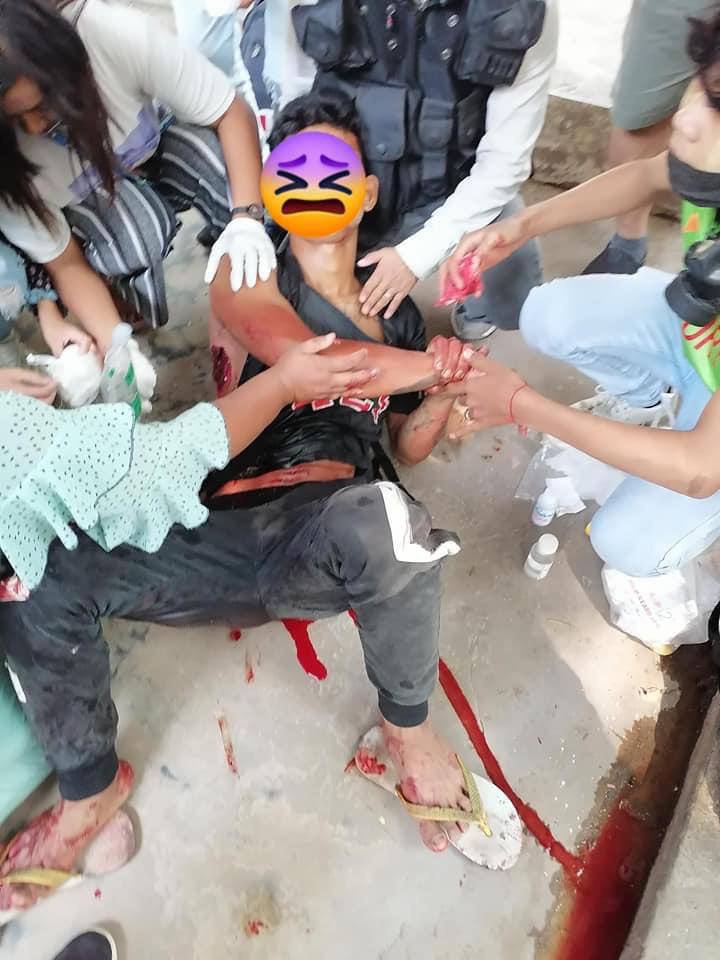 Tw // wound 
Monywa strike was brutally cracked down by military junta terrorists and injuring at least one civilian.
SUPPORT FEDERAL ARMY 
#WhatsHappeningInMyanmar 
#Apr1Coup 
#OpCCP