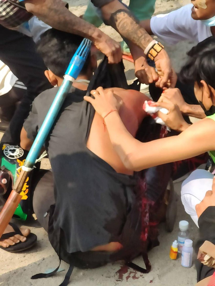 EIEIMON12416159's tweet photo. Tw // blood , wound
In Monywa, Military terrorists in civilian form shot innocent civilians. One got injured in arm.

#WhatsHappeningInMyanmar
#Apr1Coup https://t.co/PjFxzNiKVs