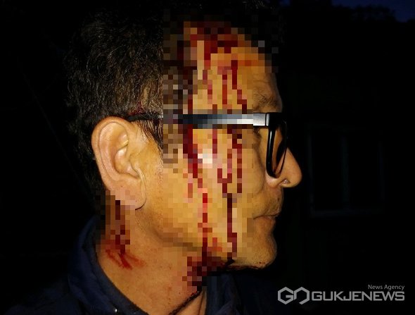 [단독] 망치에 찢긴 머리 동여매고 1인 시위 나선 포항 두원리 이장 gukjenews.com/news/articleVi…
#폭행사건 #포항폭행사건 #망치로_머리가격