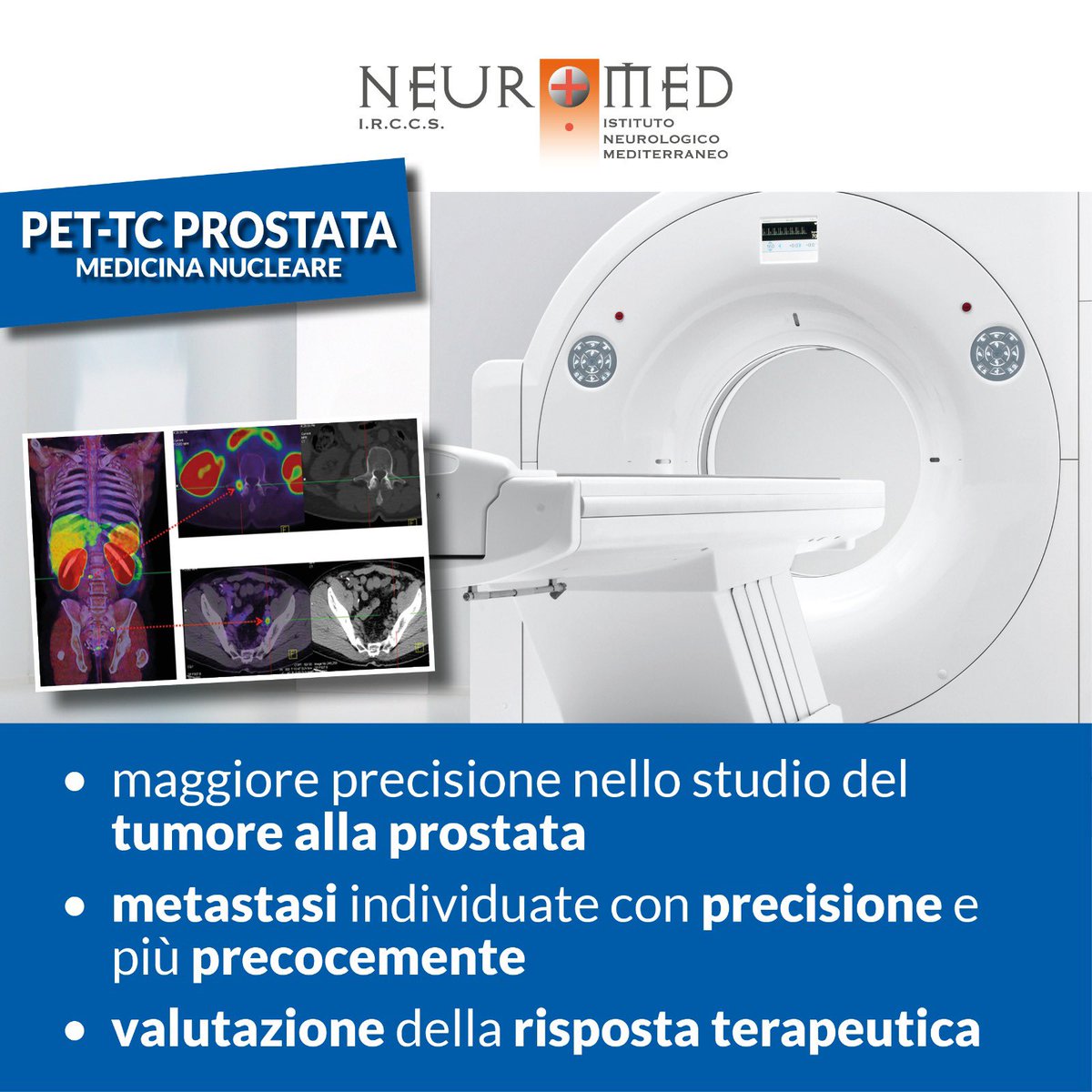 NeuromedIRCCS's tweet photo. #PETTC con PSMA per #tumoreallaprostata 

🩺 PET-PSMA è utile:
✔️nell’individuare il  tumore prostatico
✔️nella stadiazione dei pazienti già trattati
✔️per informazioni sulla risposta terapeutica. 

👉🏼 https://t.co/ZbFW5WRyDR

📞+39 0865.929244/522
✔️WhatsApp: +39 329.0331499 https://t.co/dvBHNz6VWb