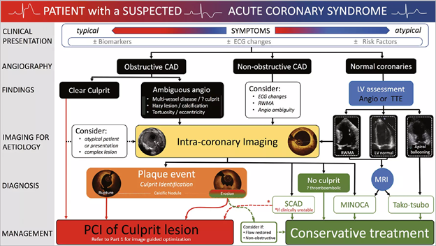 European Society of Cardiology Journals on Twitter: "16/24 Intravascular helps diagnostic/ angiographic uncertainty in the setting of ACS. can delineate luminal discontinuity/plaque disruption &amp; thrombus. OCT is capable of