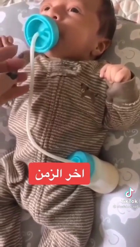 Reham0sa's tweet photo. ياجماعه اليومين دي انا شايفه مصيبة رجعت يصنعوها اللي هيا الرضاعه اللي بال tube
دي كانت سبب في موت الآلاف الرضع في العصر الفيكتوري اسمها 
Murder bottles
لأن تنظيفها صعب وكانت تجمع بكتريا فيها وميكروبات رجاء لحد يستخدمها محا يسير شي لو الأم رضعت الطفل دقيقتين من رضاعه عادية بلا كسل https://t.co/TT0FKDP6MI