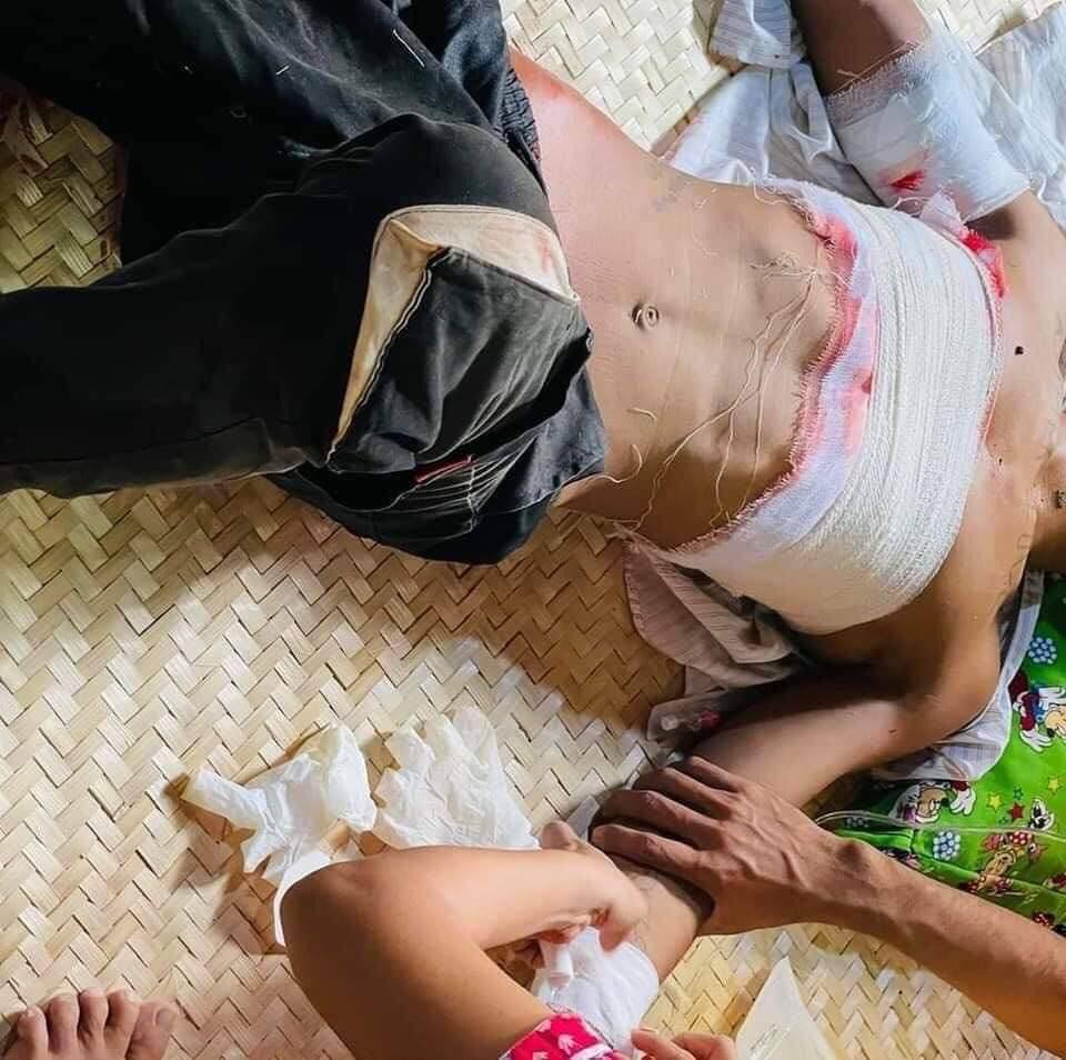 Anemone97686808's tweet photo. Fatal Shooting in Monywa on Apr 1 killed a man. A portester shot in head n died on the spot. Monywa was terrorized with guns by soldiers since early morning n there r some who got gunshot wounds too.

SUPPORT FEDERAL ARMY
#Apr1Coup
#WhatsHappeningInMyanmar https://t.co/OgqT7NJdjb