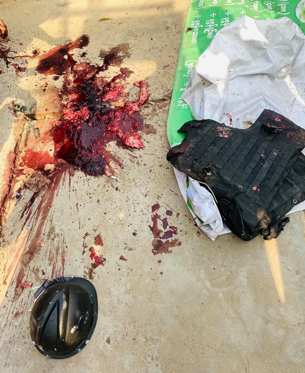 HinLucus's tweet photo. TW//blood  Headshot in Mandalay 90*41 1st April 2021. https://t.co/XFoXHG1R5P