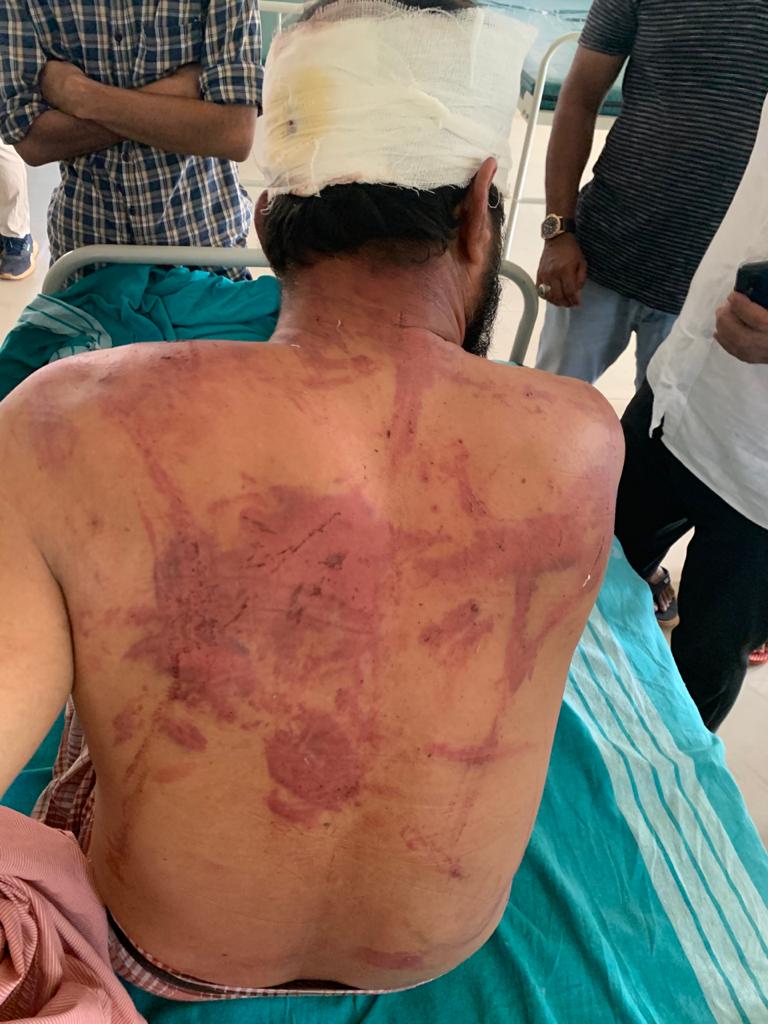 imMAK02's tweet photo. This happened in Mangalore, Karnataka.

2 Muslim men Rahiman &amp; Mustafa were brutally attacked by Hindutva goons on the accusations of being Cow Smugglers.

Both were traveling in an empty vehicle when they were attacked with iron rods. 5 arrested.

Via : @keypadguerilla https://t.co/g2gdoxVrt2