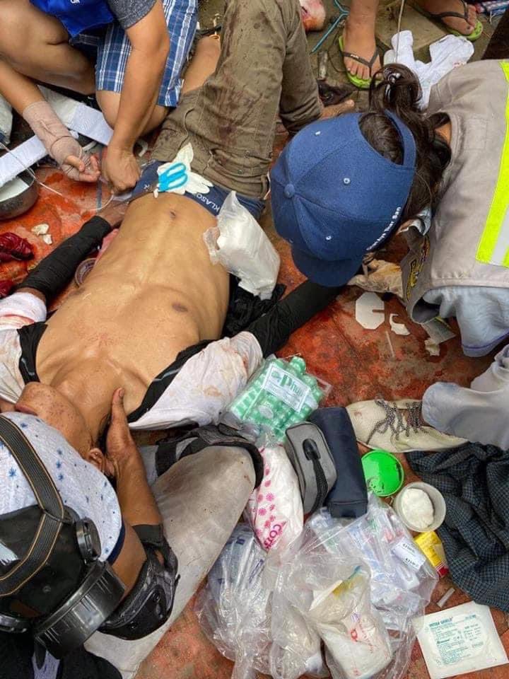 Sein Pan, Mandalay

• A protester shot in the head and taken away by Terrorists (#Myanmar security forces)

• At least 3 injured

#WhatsHappeningInMyanmar #Apr1Coup #MilkTeaAlliance