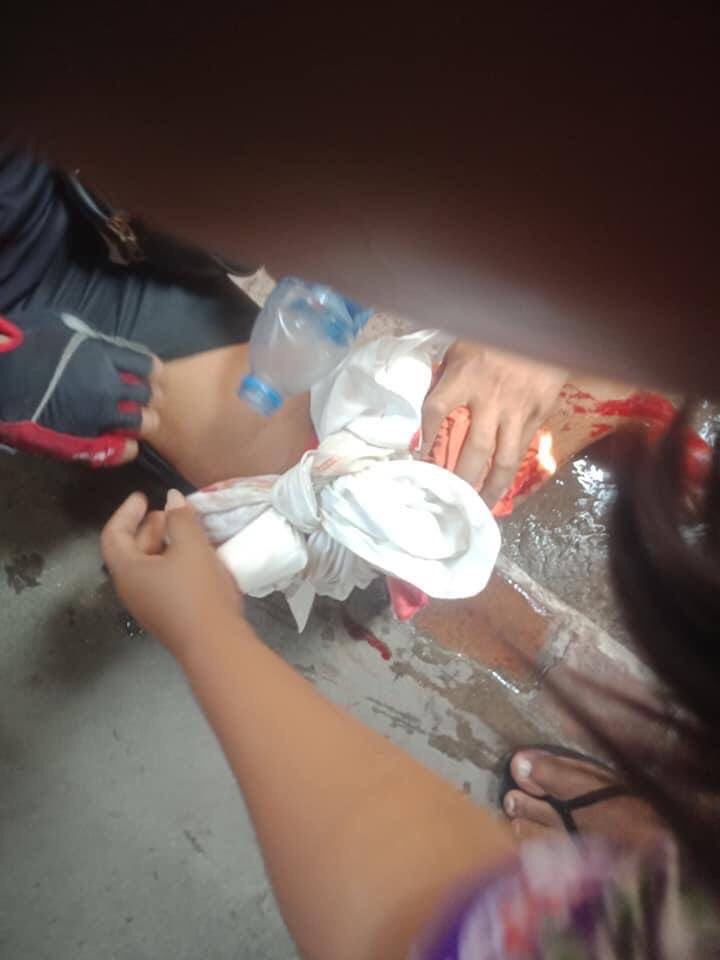 tw // blood // wound
Military terrorists raided brutally on unarmed civillians in SeinPan, Mandalay just now. At least 3 people were reportedly shot.
SUPPORT FEDERAL ARMY 
#forceavote 
#MilkTeaAlliance 
#WhatsHappeningInMyanmar
#Apr1Coup