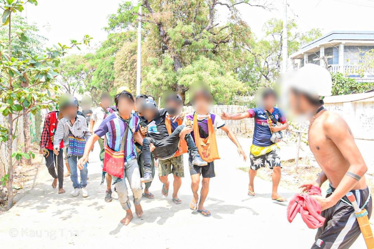 Jiyunnne's tweet photo. tw // blood
Due to brutal crackdown on Monywa strike, two more civillians were injured in the hand and nose respectively by 1pm.
SUPPORT FEDERAL ARMY 
#forceavote 
#MilkTeaAlliance 
#WhatsHappeningInMyanmar
#Apr1Coup https://t.co/iywsHnNnea