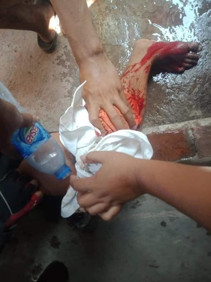 #Apri1Coup Sein Pan, Mandalay

Intense crackdown earlier. One headshot killed outright. Others injured. Shot in the abdomen/leg etc. 

#WhatsHappeningInMyanmar #Myanmar