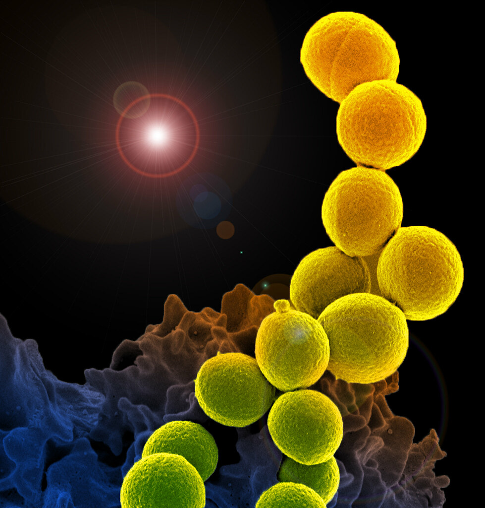 JAC-AMR (@jac_amr) on Twitter photo UF study uses cutting-edge molecular techniques to better understand how bacteria swap highly drug-resistant genes in hospital settings. Great paper by <a href="/UF_EPI/">Emerging Pathogens Institute</a> et al: academic.oup.com/jacamr/article… #JACAMRNews UF study uses cutting-edge molecular techniques to better understand how bacteria swap highly drug-resistant genes in hospital settings. Great paper by <a href="/UF_EPI/">Emerging Pathogens Institute</a> et al: academic.oup.com/jacamr/article… #JACAMRNews