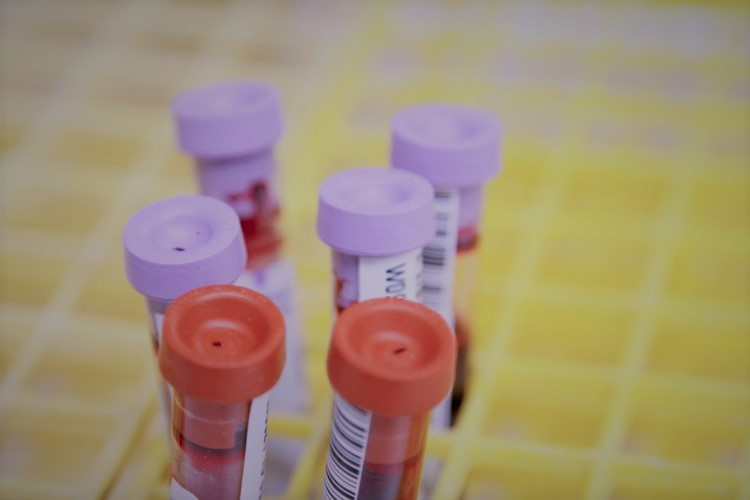 Samples4Science's tweet image. Over the years, blood donations have delivered HUGE breakthroughs in #science.

From understanding certain diseases to discovering new treatment paths for cancers, it can take one small drop 💉

👇 Get involved today 
ow.ly/l4xh50DPStp

#GiveBlood #SamplesforScience