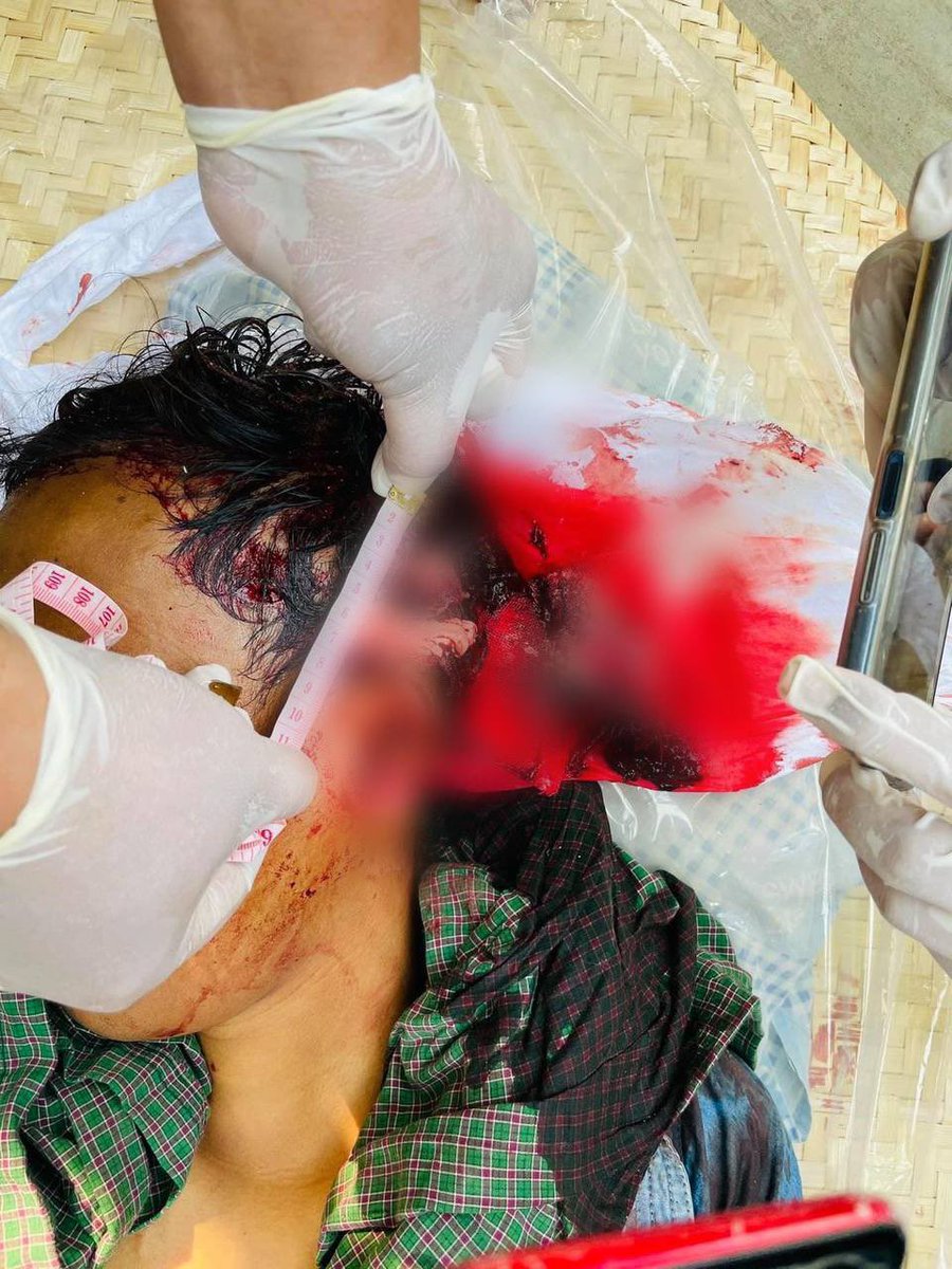 daung_official tweet media