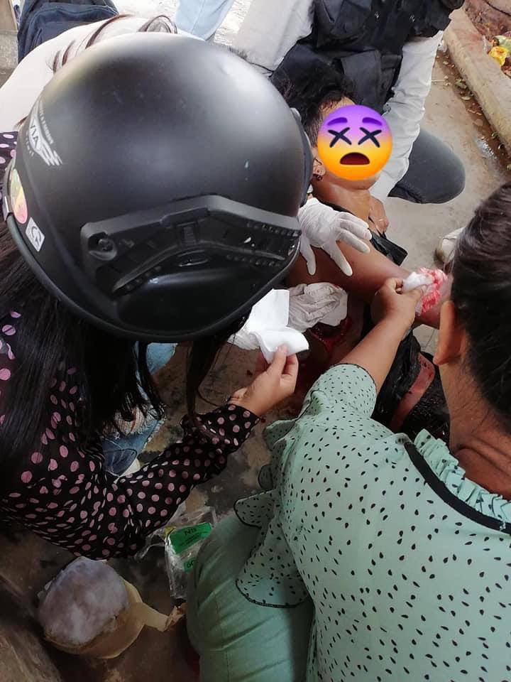 Tw // wound 
Monywa strike was brutally cracked down by military junta terrorists and injuring at least one civilian.
SUPPORT FEDERAL ARMY 
#WhatsHappeningInMyanmar 
#Apr1Coup 
#OpCCP
