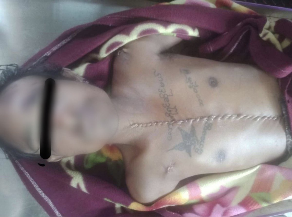 #Apr1Coup South Dagon

BODY OPENED. Aung Min Thu (37yr) was shot in South Dagon on 31 March. He was hit chest &amp; back. Today returned  with chest &amp; abdomen opened. 
SAC junta denying dignity to those it kills. 

His tattoos: "I will face the world" and "Battle of life" 

#Myanmar