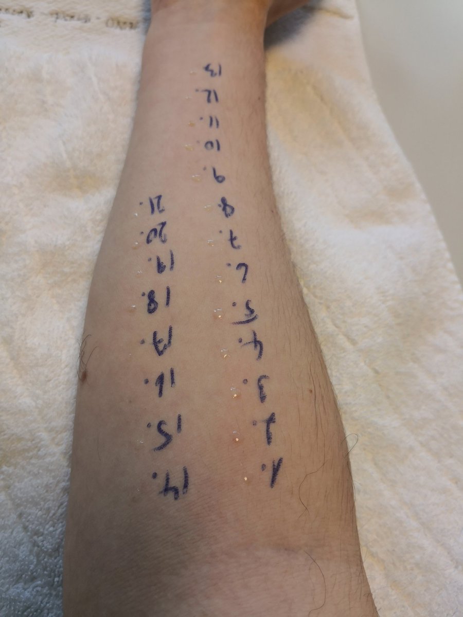 Lighti85's tweet photo. Jetzt heißt es warten.
Bin gespannt.
#Allergietest https://t.co/vjBaCo10Dq