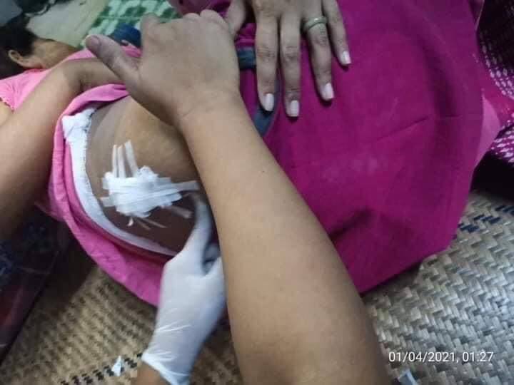 Soldiers Shot Pregnant Woman on Mar 31; When armed forces opened fire in residence of South Dagon, a pregnant woman was shot in waist though she was hiding in her house. Many men were brutally beaten too.

SUPPORT FEDERAL ARMY
#Apr1Coup
#WhatsHappeningInMyanmar