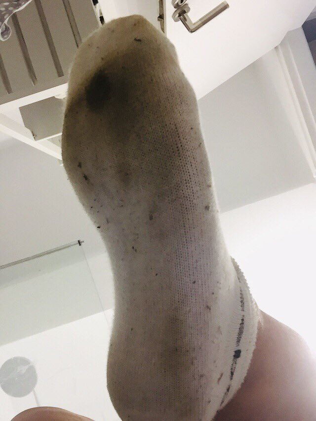 aphrodite_foot's tweet photo. Wouldn’t you just love to be beneath these dirty feet #feetfetish #dirtyfeet #femdom #walletdrain #buymesomenewsocks #dirtysoles #solesandtoes #feetpics #buymysocks https://t.co/m9k0B7FtVU
