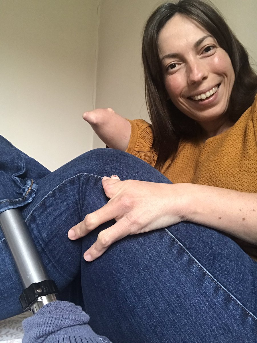 It’s rare that you’re gonna see all three of my limb different limbs in one photo, but in celebration of my fricken awesome body, here’s all three in one shot! Happy #LimbLossLimbDifference Awareness Month— owning this every single day #DisabilityTwitter