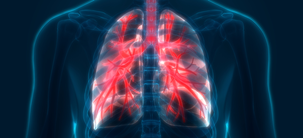 cancerscnews's tweet photo. 🫁 Drs. Liancheng Lin and Shouguo Li identified a novel MCF2L‐AS1/miR‐873‐5p regulatory axis responsible for the #CSC‐like traits of #NSCLCs.
https://t.co/S58m5L30H8 https://t.co/ABXn4lchYR