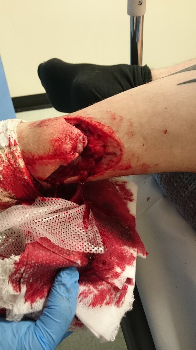 Hartlepool Elite Boxing Academy tweet media