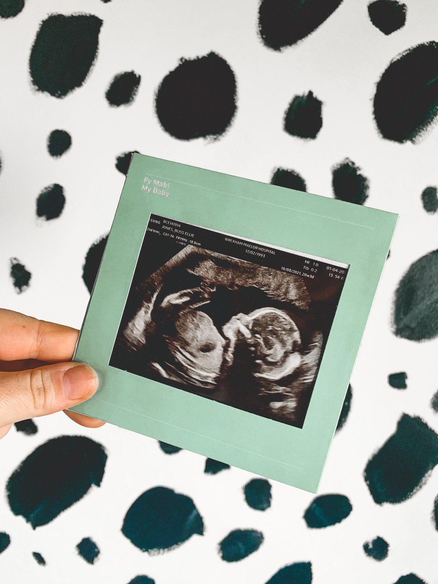 Bliss_Jones's tweet photo. 20 weeks 🥰 https://t.co/rwsVvT8D3m