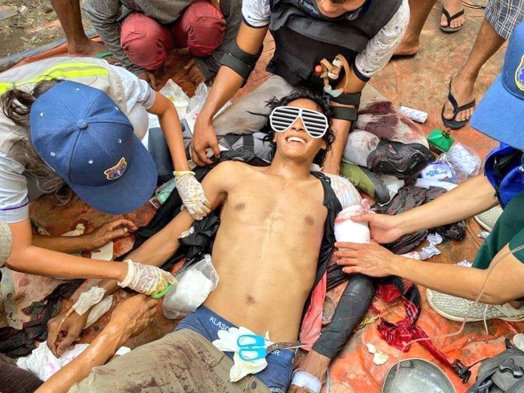 Little_winnie_'s tweet photo. He was shot with live bullet.
And he's like"F**k it, I'm gonna protest again tmr"
#WhatsHappeninglnMyanmar 
#April1stCoup #Mandalay #Seinpan https://t.co/yD9B8IEE3K